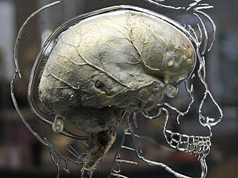 Scientists grow human brain